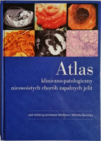Książka Atlas kliniczno-patologiczny nieswoistych chorób zapalnych jelit